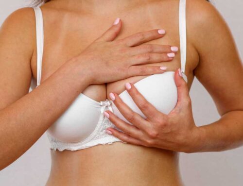 ¿Cómo evolucionan las cicatrices de una reducción mamaria?
